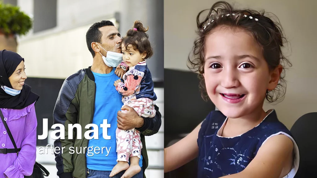 janat before after 2
